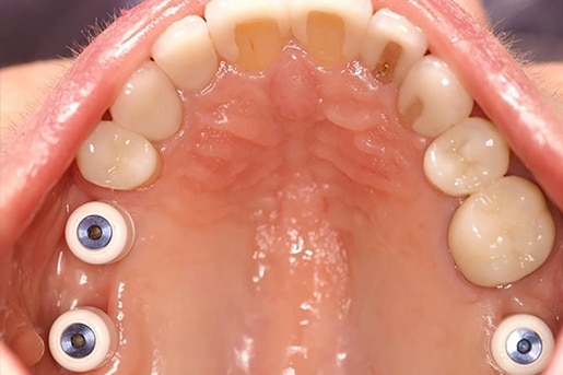 Patient smile before treatment at Young Dental Health Center