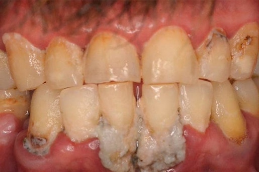 Patient smile before treatment at Young Dental Health Center