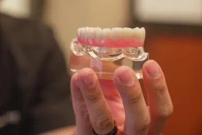 Dental implant model held by an Upland implant dentist